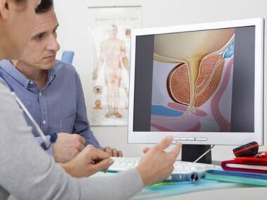 Ein Urologe berät einen Patienten bei Potenzproblemen